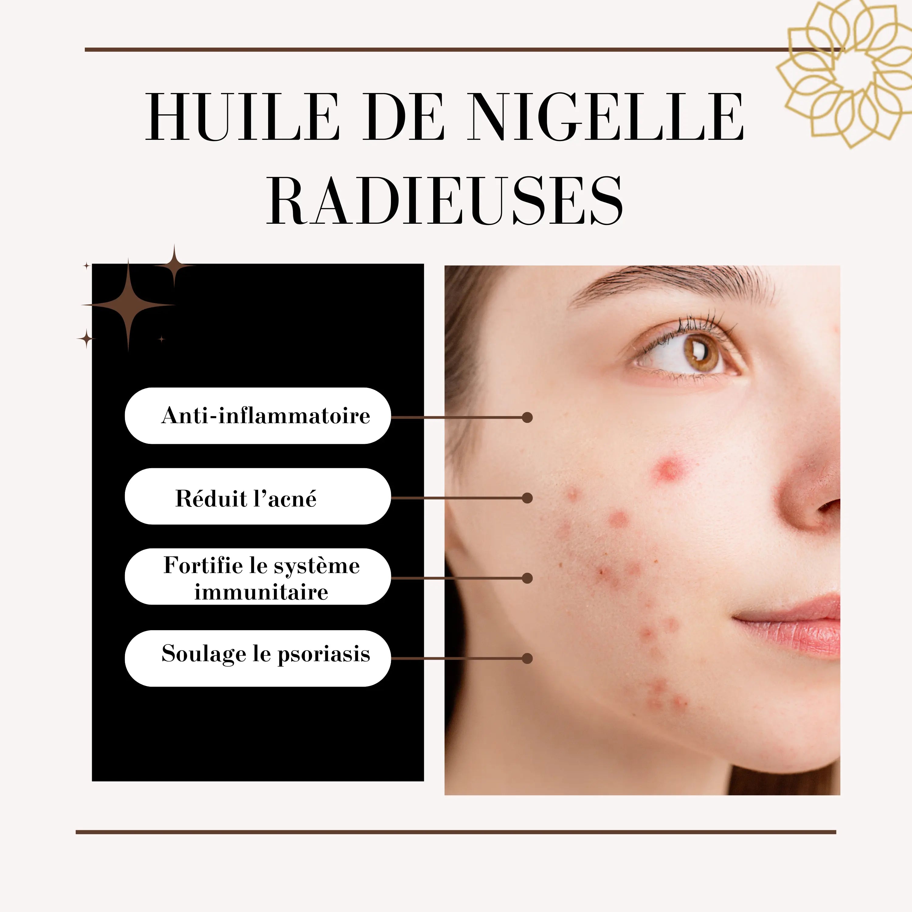 huile de nigelle 30ml RADIEUSES