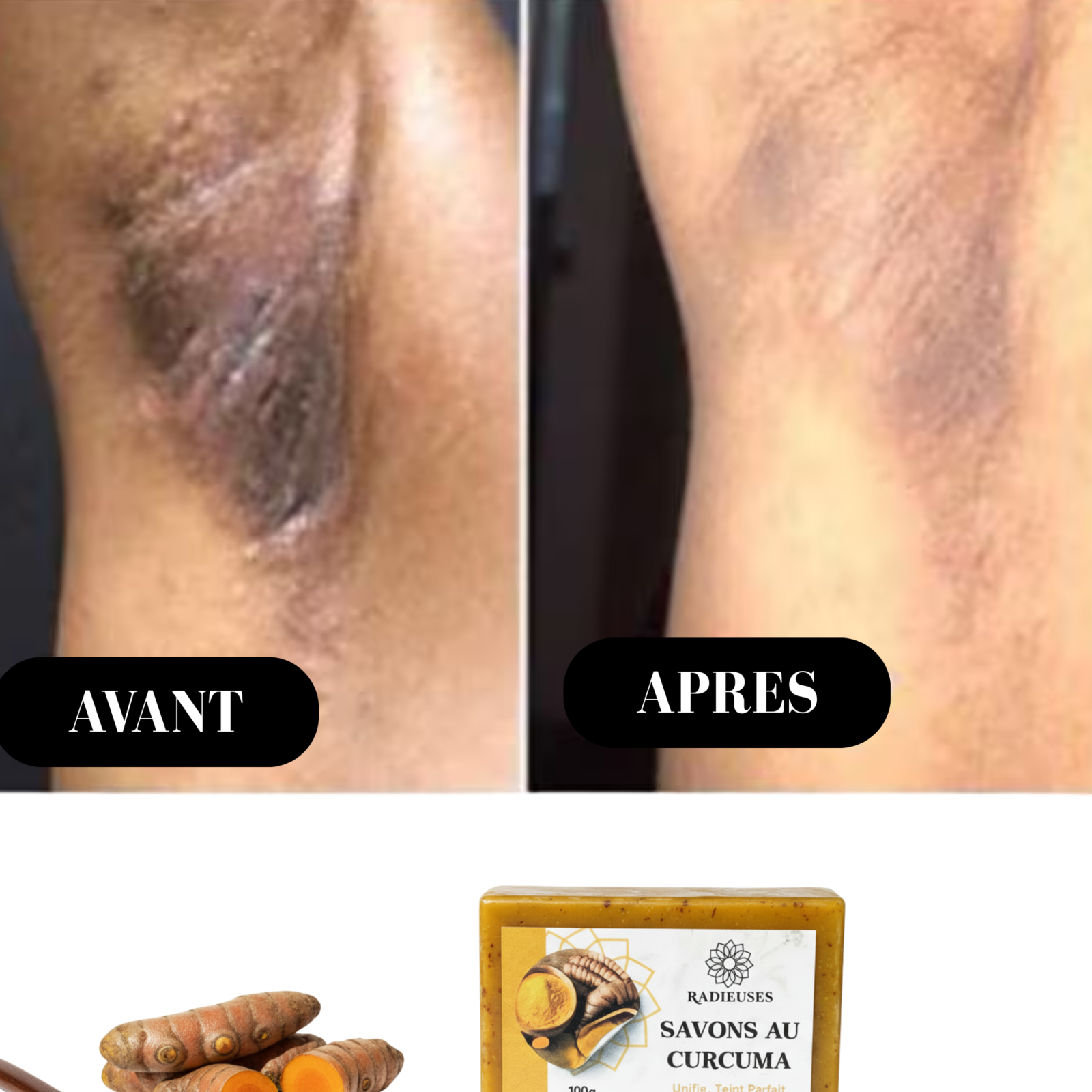 avant-apres-savon de-curcuma -sur aiselles