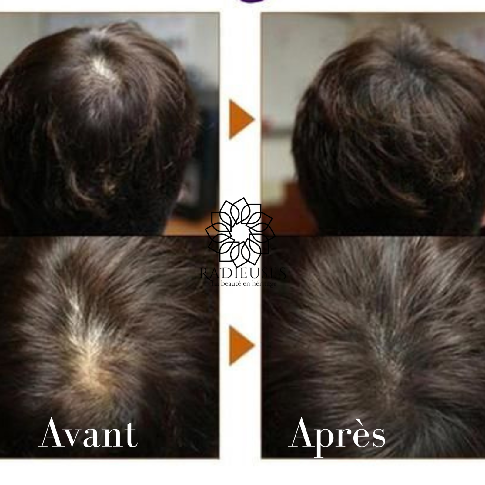 avant apres utilisation d'huile anti chute