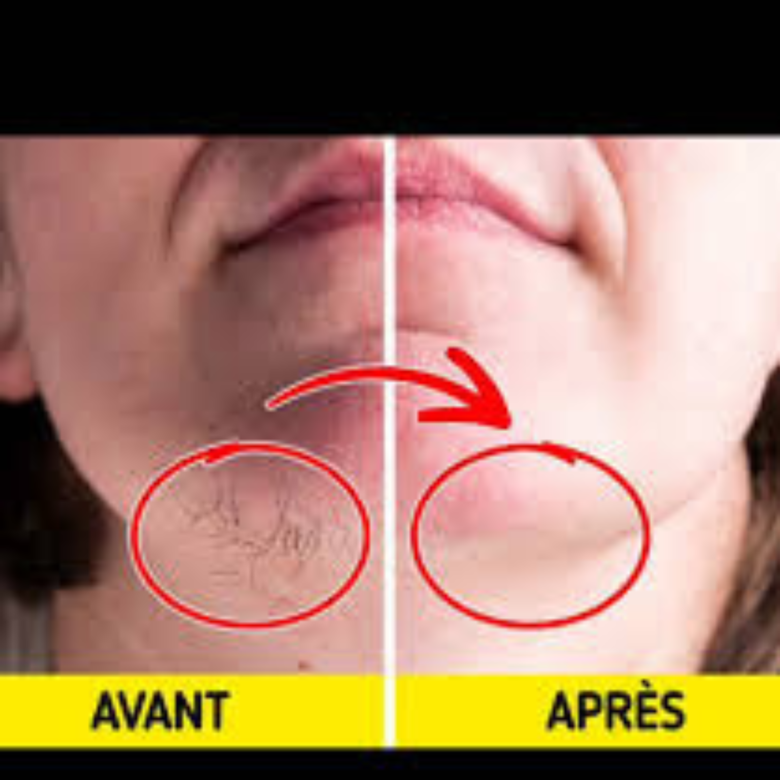 avant-apres-huile-de-souchet-radieuses